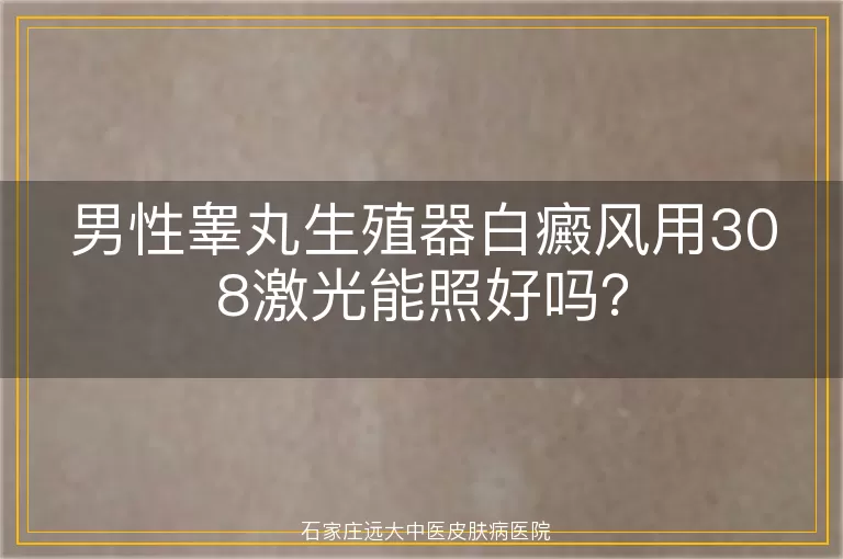 男性睾丸生殖器白癜风用308激光能照好吗？