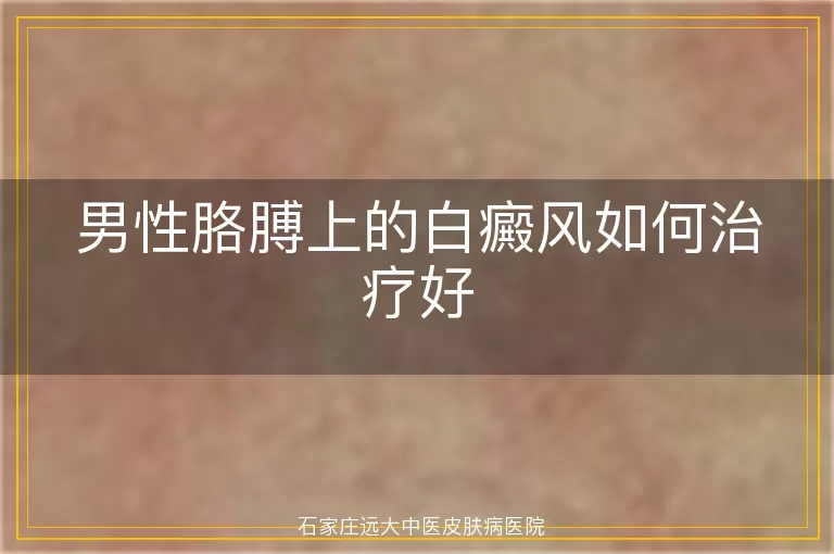 男性胳膊上的白癜风如何治疗好