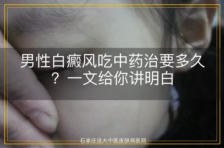 男性白癜风吃中药治要多久？一文给你讲明白