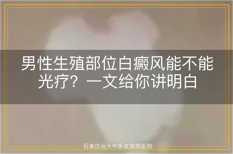 男性生殖部位白癜风能不能光疗？一文给你讲明白