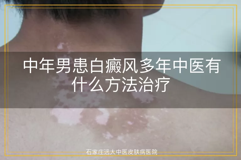 中年男患白癜风多年中医有什么方法治疗