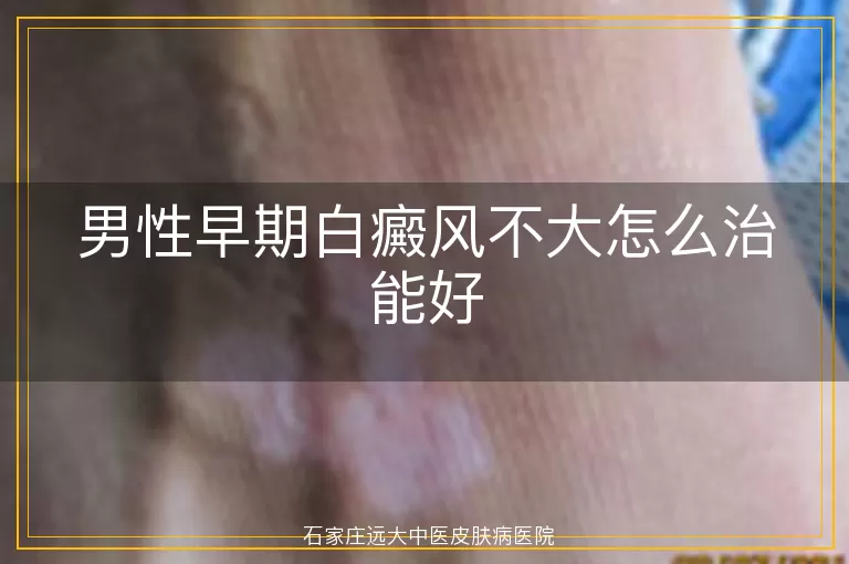 男性早期白癜风不大怎么治能好