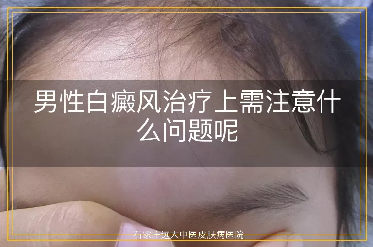 男性白癜风治疗上需注意什么问题呢