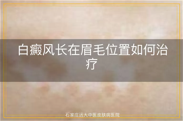 白癜风长在眉毛位置如何治疗
