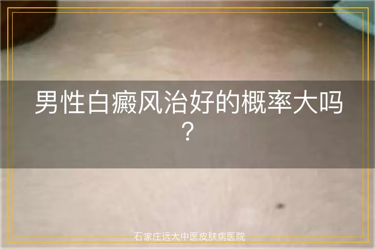 男性白癜风治好的概率大吗？