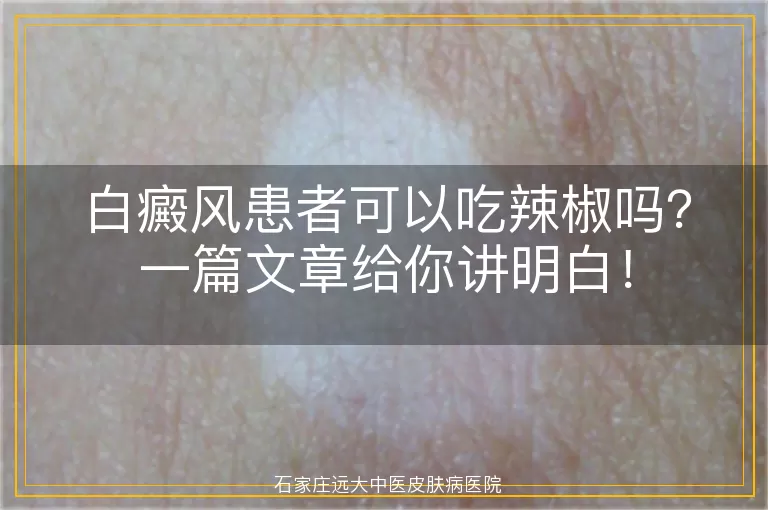 白癜风患者可以吃辣椒吗？一篇文章给你讲明白！