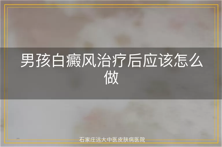 男孩白癜风治疗后应该怎么做