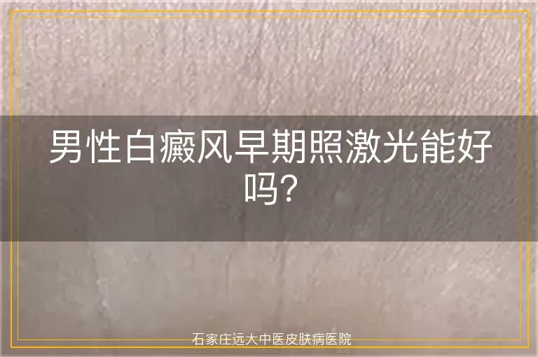 男性白癜风早期照激光能好吗？