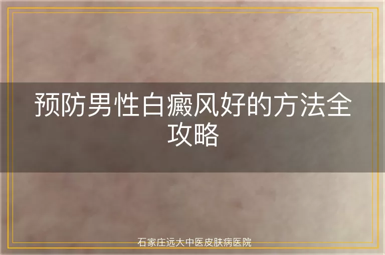 预防男性白癜风好的方法全攻略