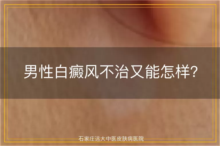 男性白癜风不治又能怎样？