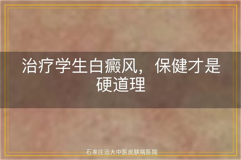 治疗学生白癜风，保健才是硬道理