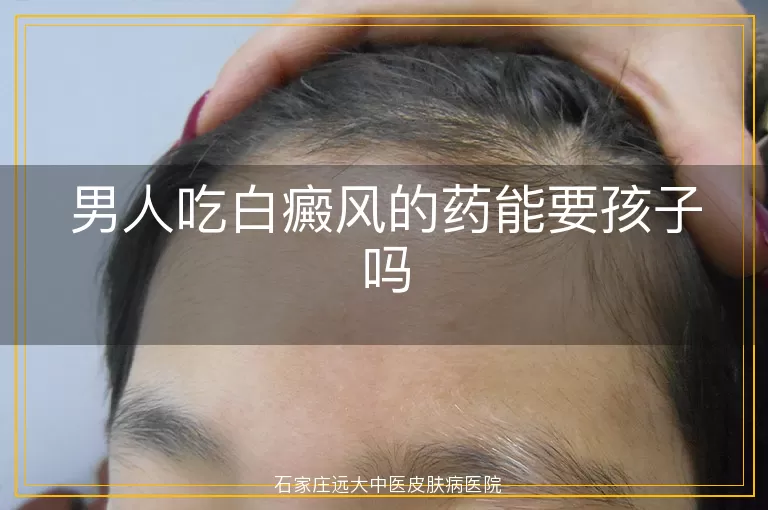 男人吃白癜风的药能要孩子吗