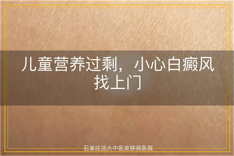 儿童营养过剩，小心白癜风找上门