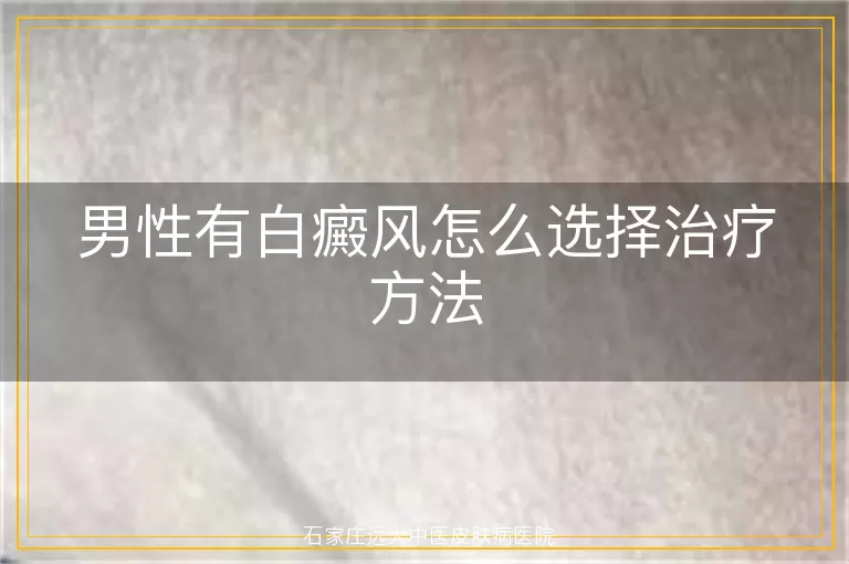 男性有白癜风怎么选择治疗方法
