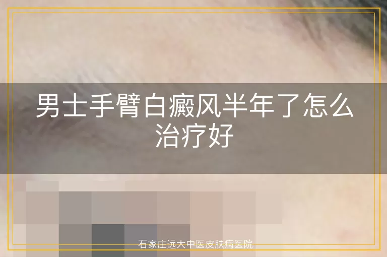 男士手臂白癜风半年了怎么治疗好