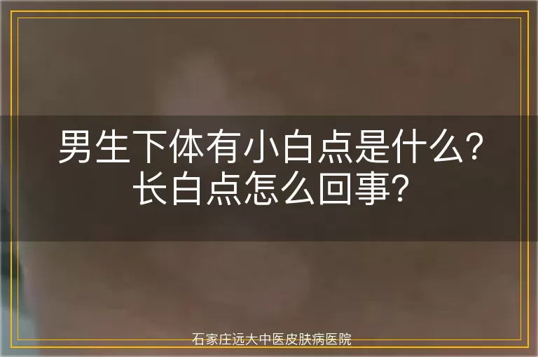 男生下体有小白点是什么?长白点怎么回事?