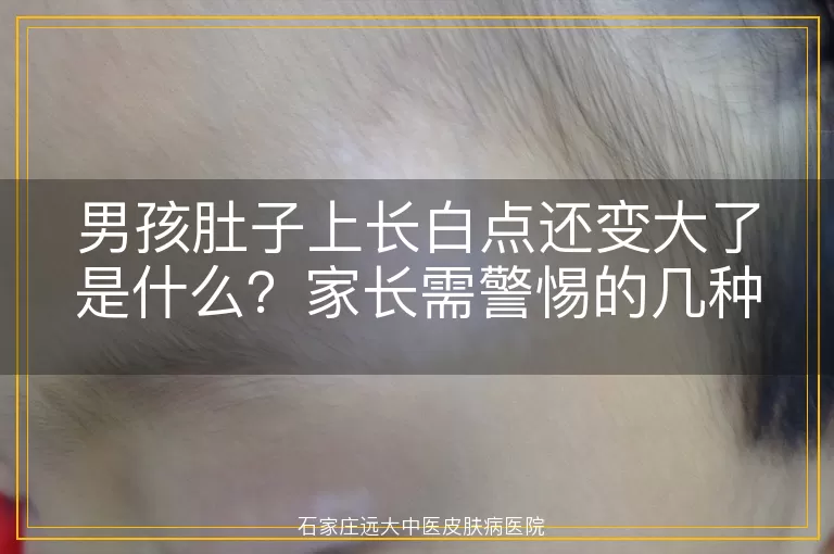 男孩肚子上长白点还变大了是什么？家长需警惕的几种可能