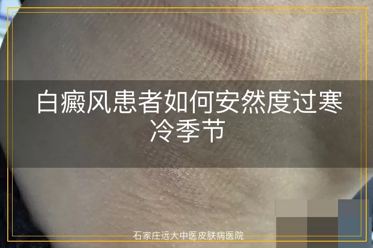 白癜风患者如何安然度过寒冷季节