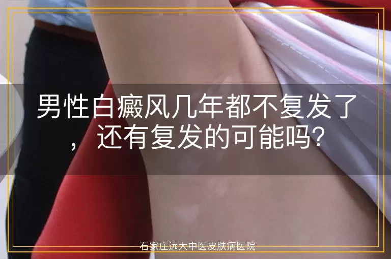 男性白癜风几年都不复发了，还有复发的可能吗？