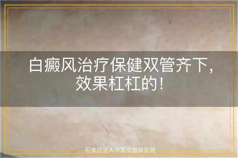 白癜风治疗保健双管齐下，效果杠杠的！