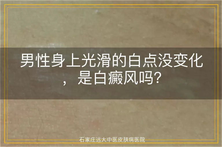 男性身上光滑的白点没变化，是白癜风吗？