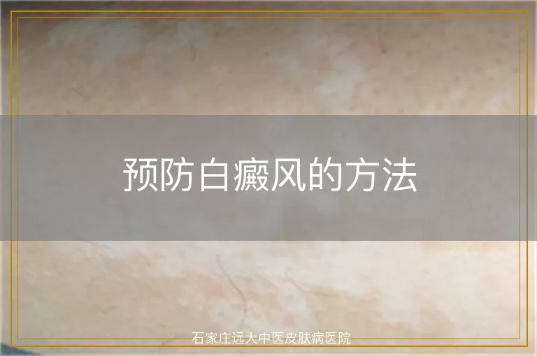 预防白癜风的方法