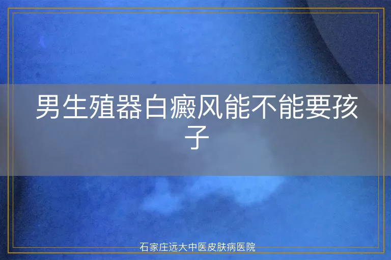 男生殖器白癜风能不能要孩子