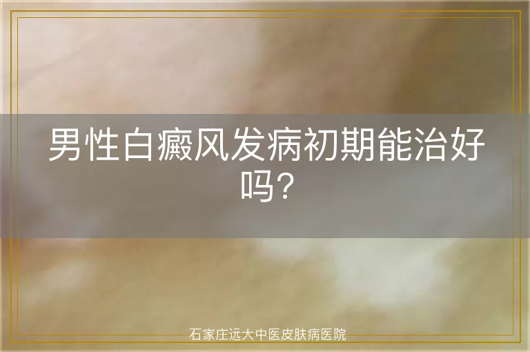 男性白癜风发病初期能治好吗?