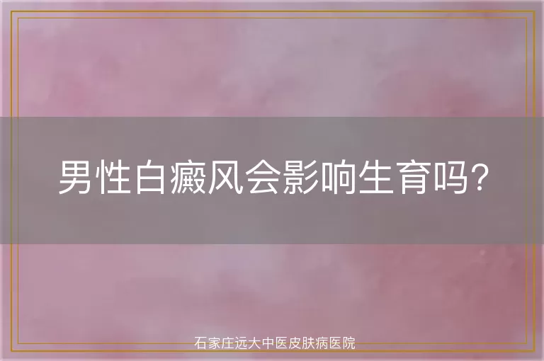 男性白癜风会影响生育吗?