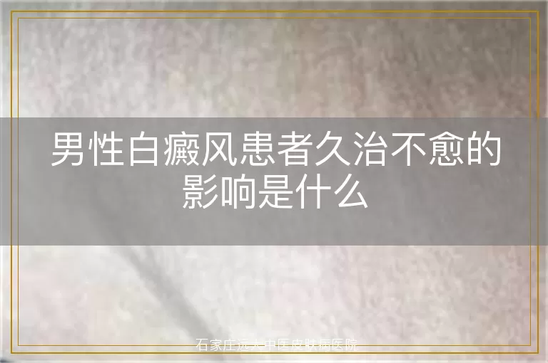 男性白癜风患者久治不愈的影响是什么