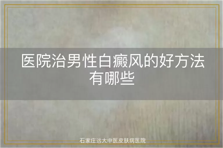医院治男性白癜风的好方法有哪些