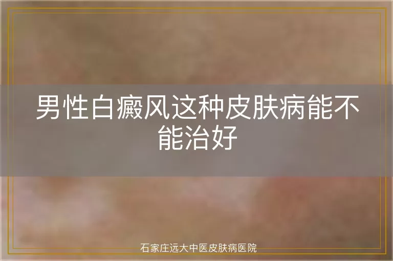 男性白癜风这种皮肤病能不能治好