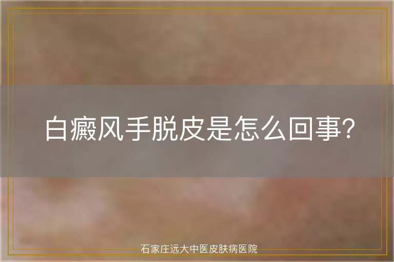 白癜风手脱皮是怎么回事？