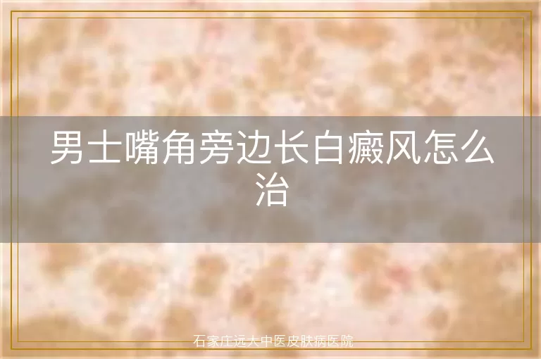 男士嘴角旁边长白癜风怎么治