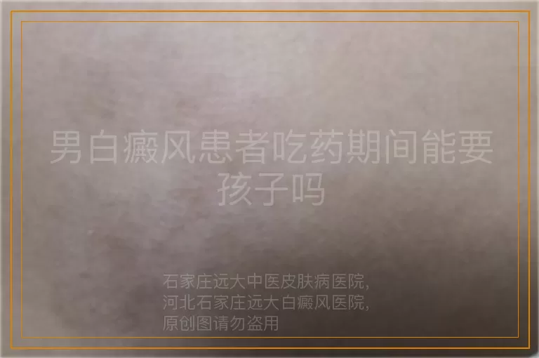 男白癜风患者吃药期间能要孩子吗
