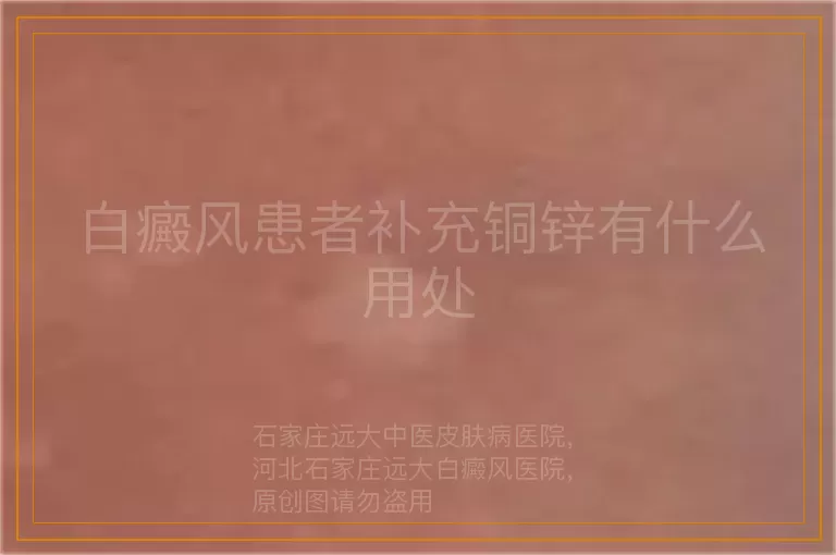 白癜风患者补充铜锌有什么用处
