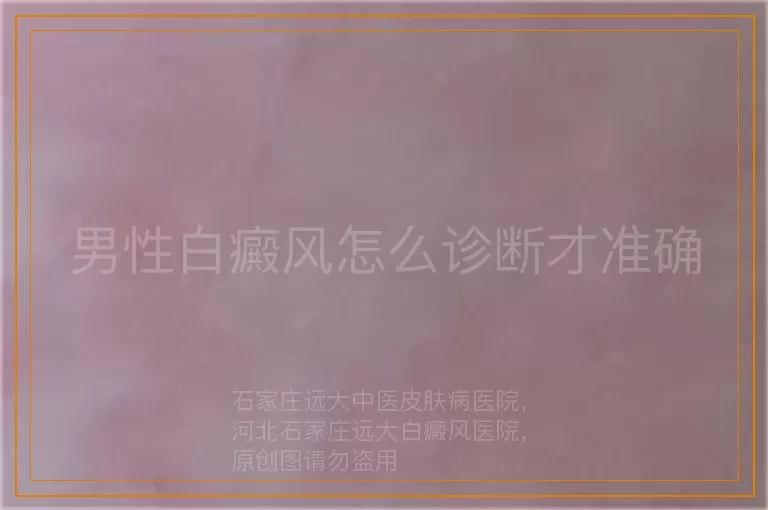 男性白癜风怎么诊断才准确