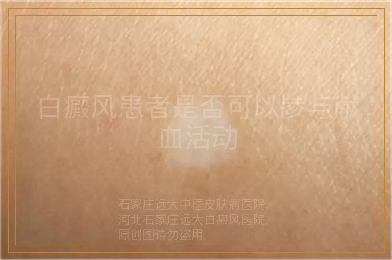 白癜风患者是否可以参与献血活动