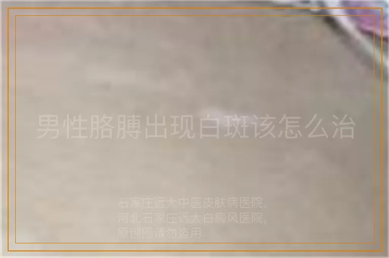 男性胳膊出现白斑该怎么治