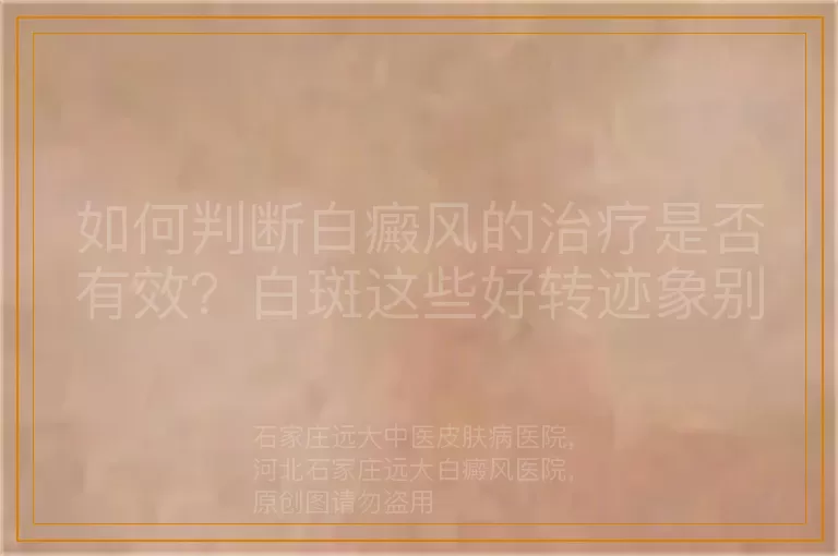 如何判断白癜风的治疗是否有效？白斑这些好转迹象别错过