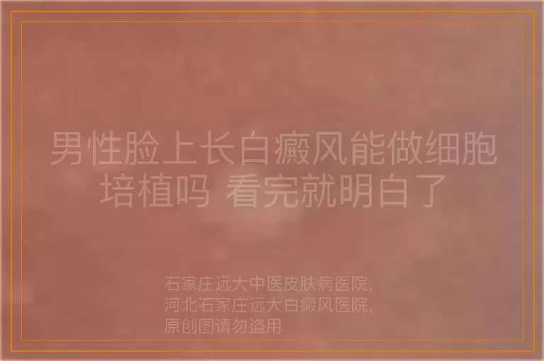 男性脸上长白癜风能做细胞培植吗 看完就明白了