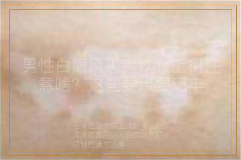 男性白癜风患者饮食上得注意啥？这些要点要记牢