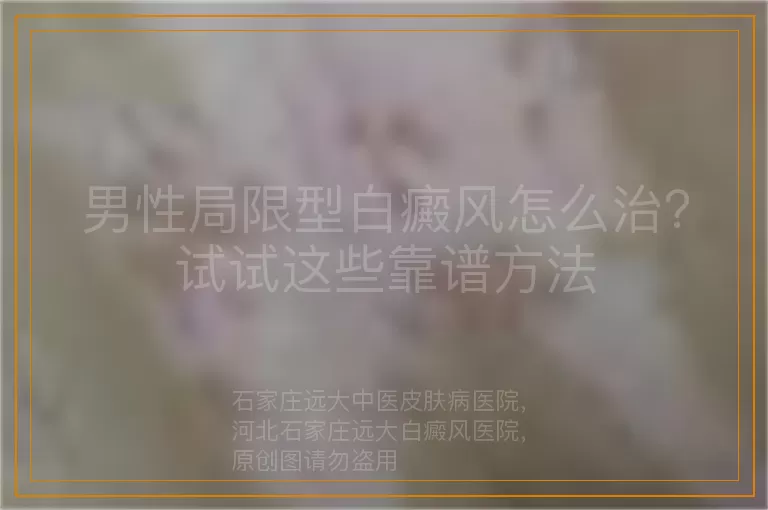 男性局限型白癜风怎么治？试试这些靠谱方法