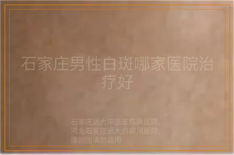 石家庄男性白斑哪家医院治疗好