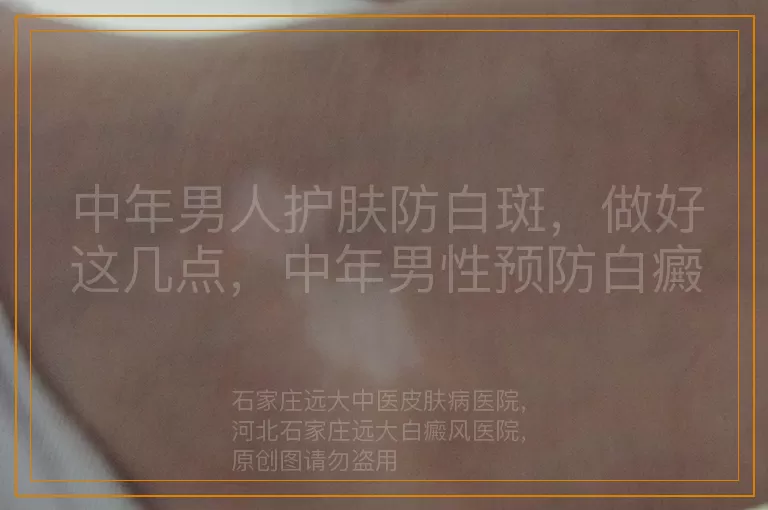 中年男人护肤防白斑，做好这几点，中年男性预防白癜风护肤指南，男士有效护肤远离白癜风困扰