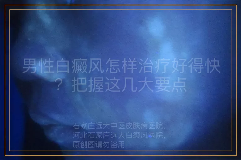 男性白癜风怎样治疗好得快？把握这几大要点