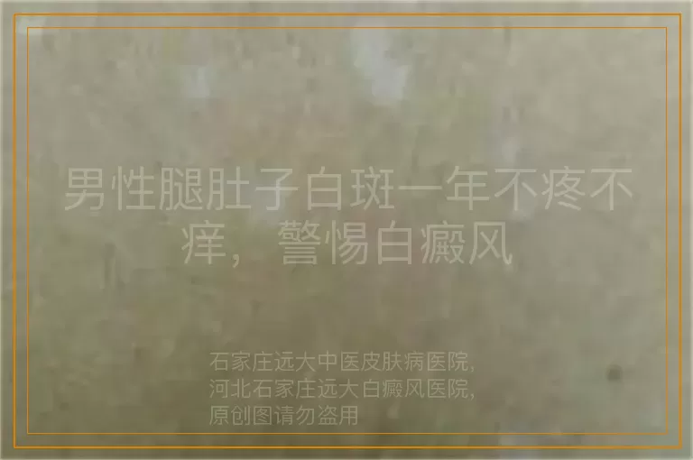 男性腿肚子白斑一年不疼不痒，警惕白癜风