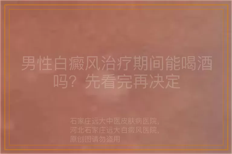 男性白癜风治疗期间能喝酒吗？先看完再决定
