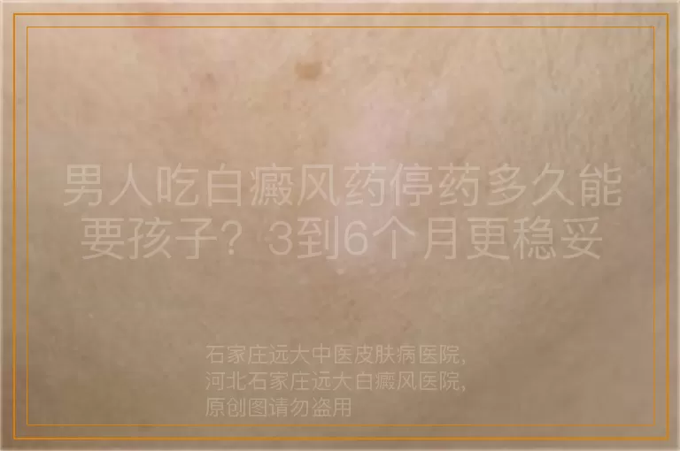 男人吃白癜风药停药多久能要孩子？3到6个月更稳妥