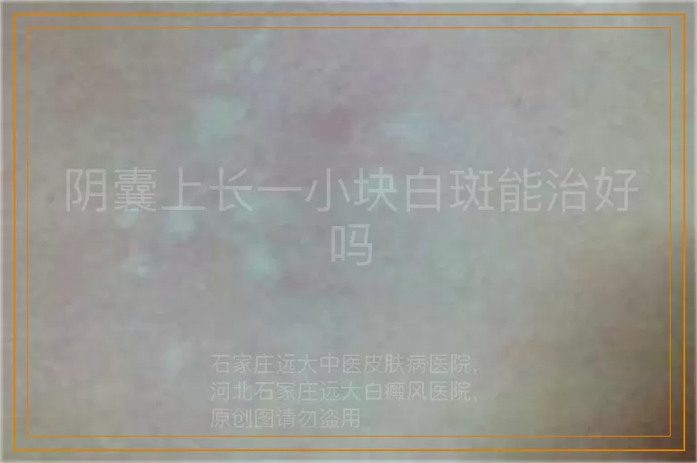 阴囊上长一小块白斑能治好吗